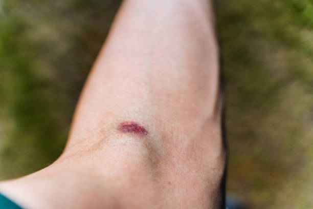 Your Body’s Trauma Response